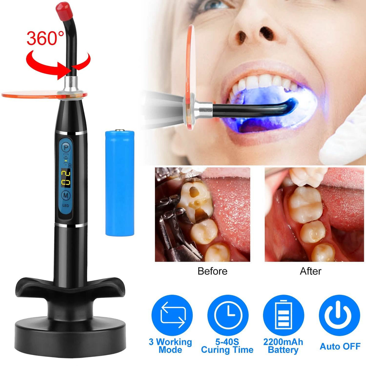 5W Cordless Dental LED Curing Light